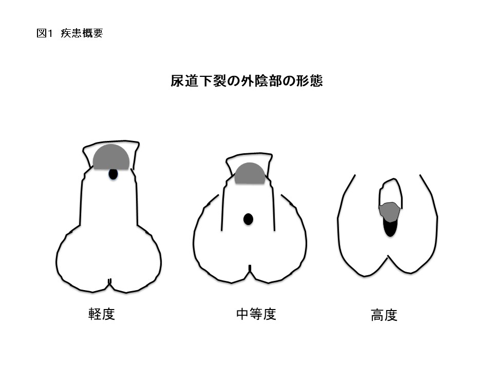 初撮りモデルは下反りデカチン!?電マの刺激にチンポはガチガチ! - ゲイ動画配信サイトKO