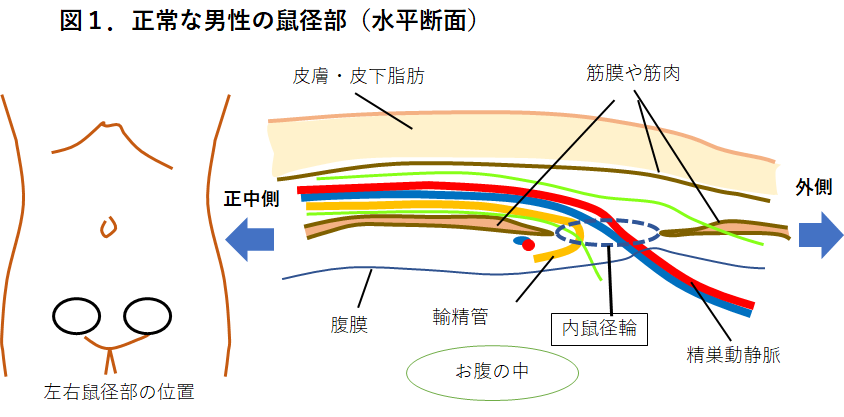 股のところに膨らみが？脱腸かもしれません。 | 西宮で内科・胃カメラ・大腸カメラ・おしっこの悩みなら『ほその内科 おなかクリニック』