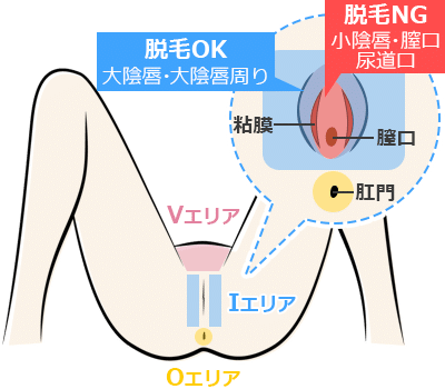 パイパンとは？パイパンのメリット・デメリットを解説