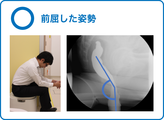 アナル洗浄のやり方は？おすすめの道具や確実なコツ、注意点について解説！｜風じゃマガジン