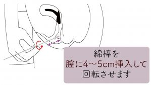 風俗利用後に不安がある場合 | 子宮頸がん・STD検査のアイラボ（東京都