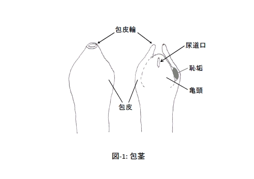 長茎術 | メンズライフクリニック【公式】