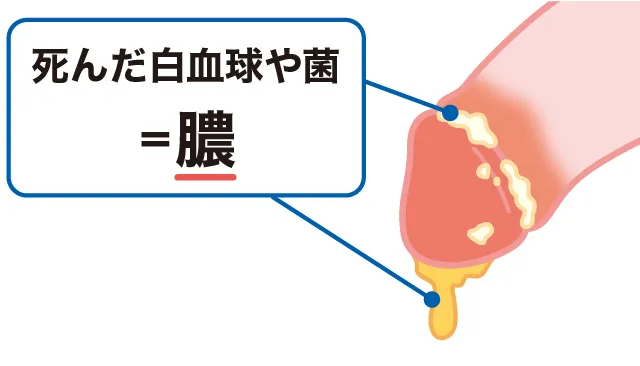 あの『ペニスの形』には意味があるの？ちんこの亀頭があの形の理由【ラブコスメ】