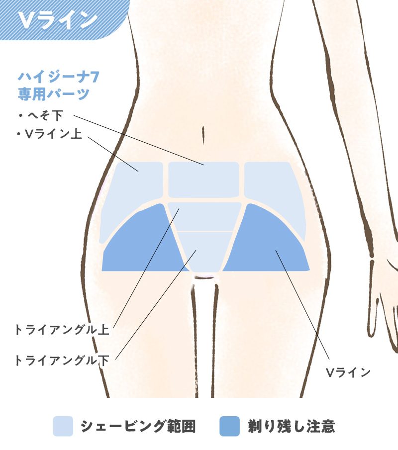 ⏩トライアングル脱毛のコース値段と回数や効果🍀ミュゼプラチナム✨