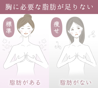 離れ乳は改善できる？離れ乳の原因・チェック方法と改善策 | 豊胸・バストアップなら南クリニック