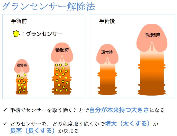 でかいちんこの基準とは？日本人平均や大きくする方法を解説 |【公式】ユナイテッドクリニック