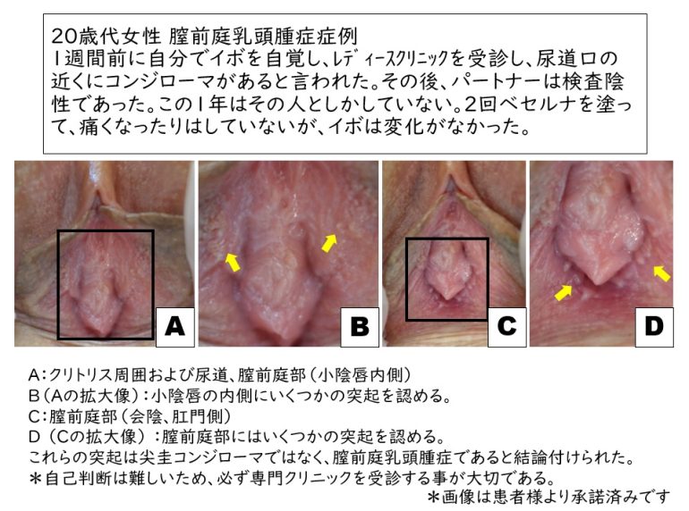 小陰唇のお悩み|福岡ブリスクリニック