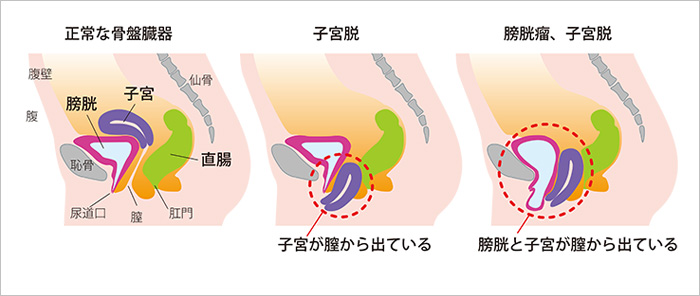 半田瞳👩‍🎓|筋膜ケアで自分らしい人生を | 膣から空気がでる