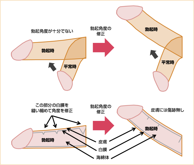 旦那のペニスが小さい？バレず着実にペニスを増大させる3つの方法を解説！ | ザヘルプM