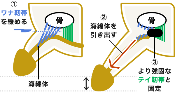 泌尿器科専門医 ドクター尾上の医療ブログ: 【性器の悩み】