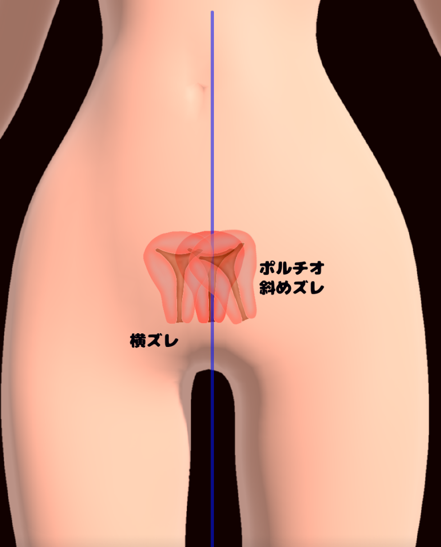 リアル膣肉の生挿入感触を感じれるオナホ | 大人のためのアダルト通販情報アナシー