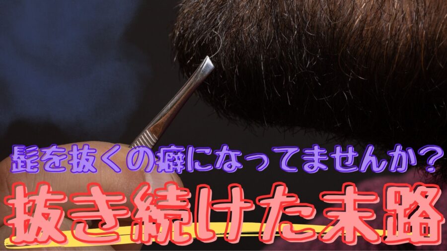 ヒゲを抜くと青ひげ無くなる？【実際に検証】10年抜いてきたメリット・デメリット｜ヒゲシェア