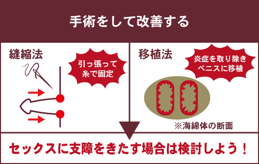 ペニスが曲がっている事で女性の身体に負担がかかっている？屈曲陰茎とは？ – メンズ形成外科 |