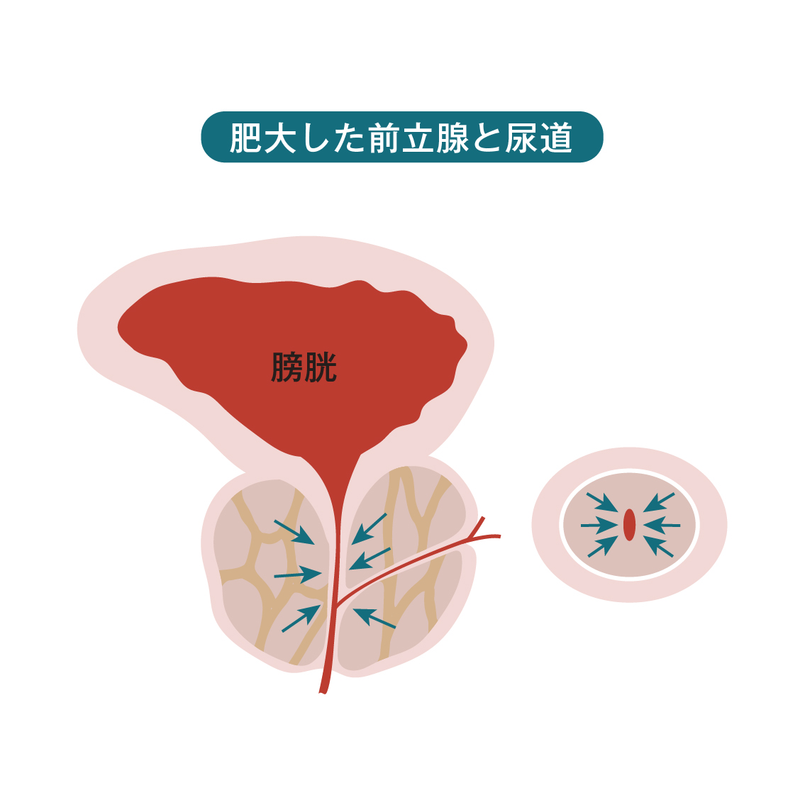 男の前立腺の場所 | 【きもイク】気持ちよくイクカラダ