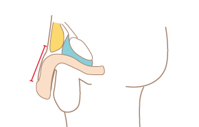長茎術 – 包茎なら表参道 青森