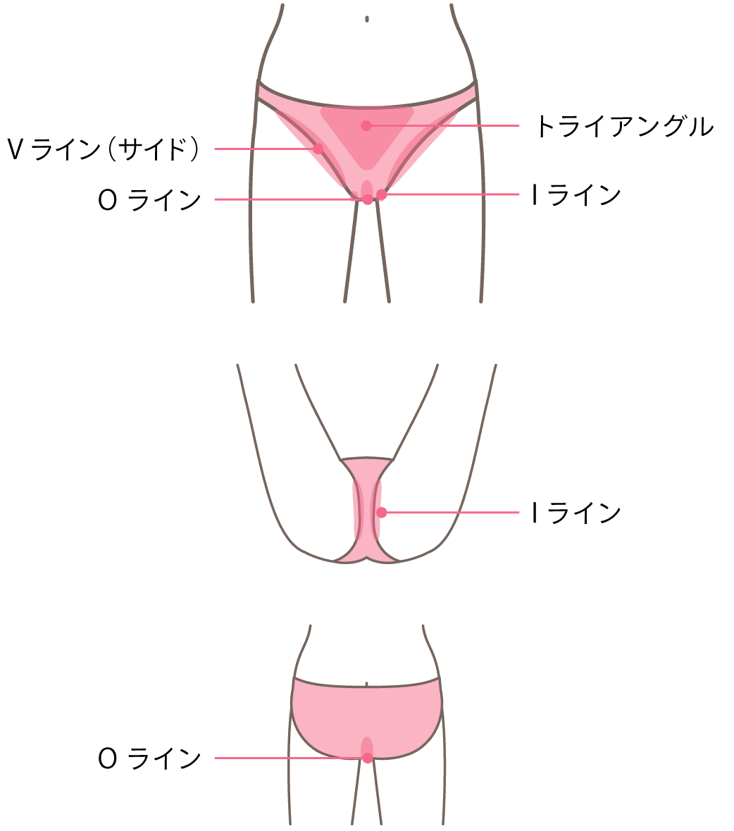 VIO脱毛 - 医療脱毛・医療レーザー脱毛ならトイトイトイクリニック