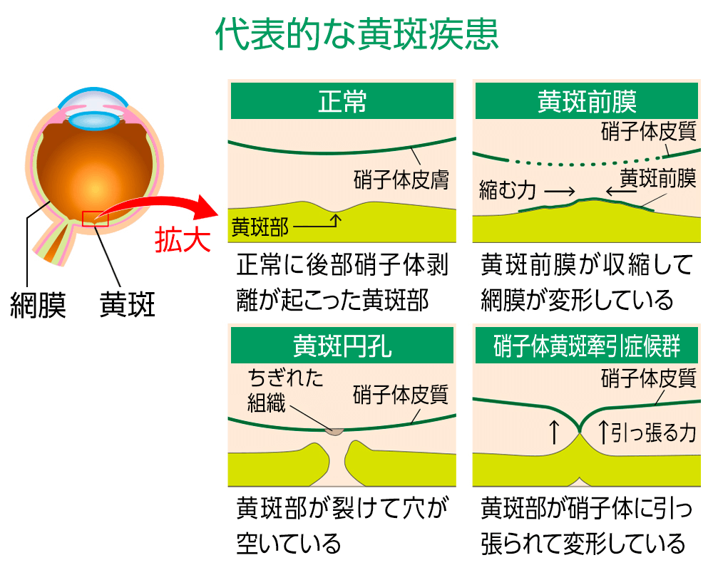 剥」の書き方 - 漢字の正しい書き順(筆順)